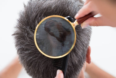 Your Hair and Scalp Can Say a Lot About Your Health