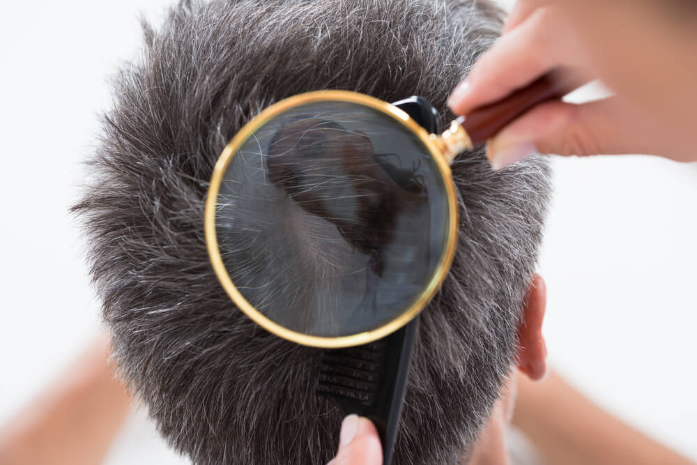 Your Hair and Scalp Can Say a Lot About Your Health